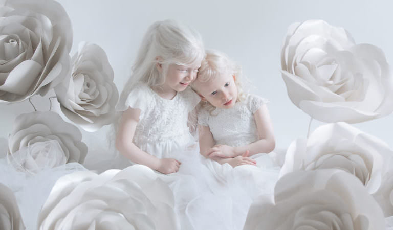 The Photographer Captures The Beauty of Albino People