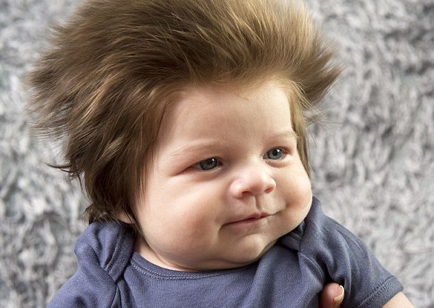 Miraculous Growth Of Hair of This Boy is The In-thing These Days