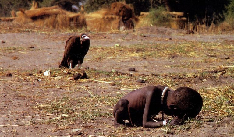 Extreme Hunger is Leading Africa to Extreme Disabilities