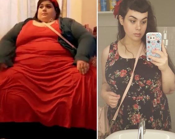 23-Year-Old Weighed 657 Pounds, Changes 3 Basic Things And Loses 400 Pounds